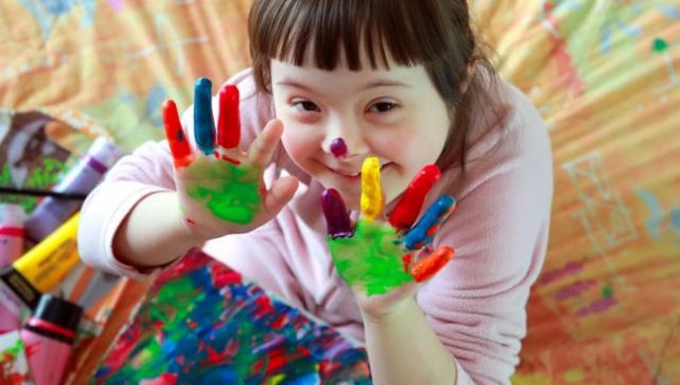 Vision Problems in People with Down Syndrome - Down TV: Portal de